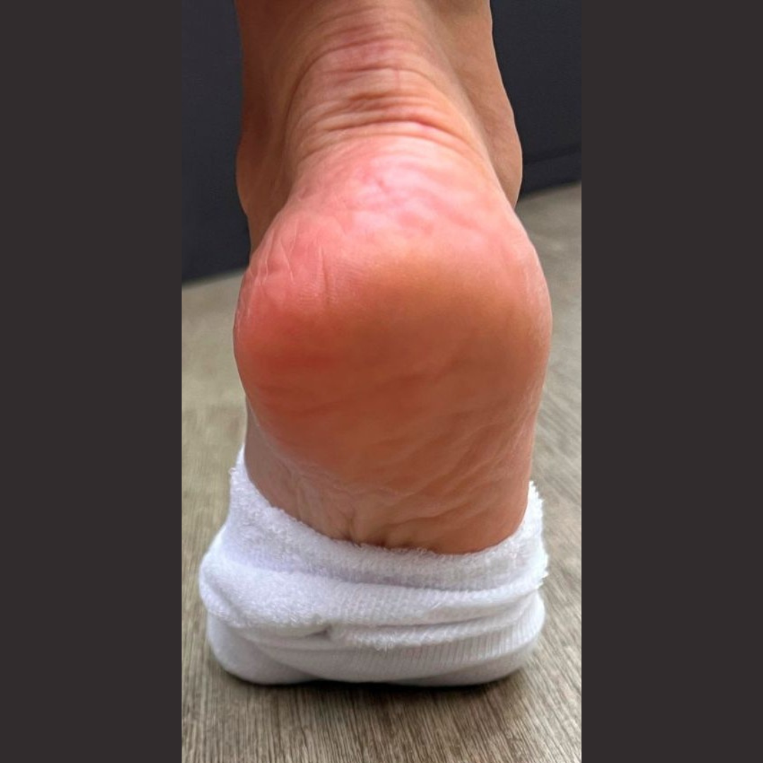 image comparison after